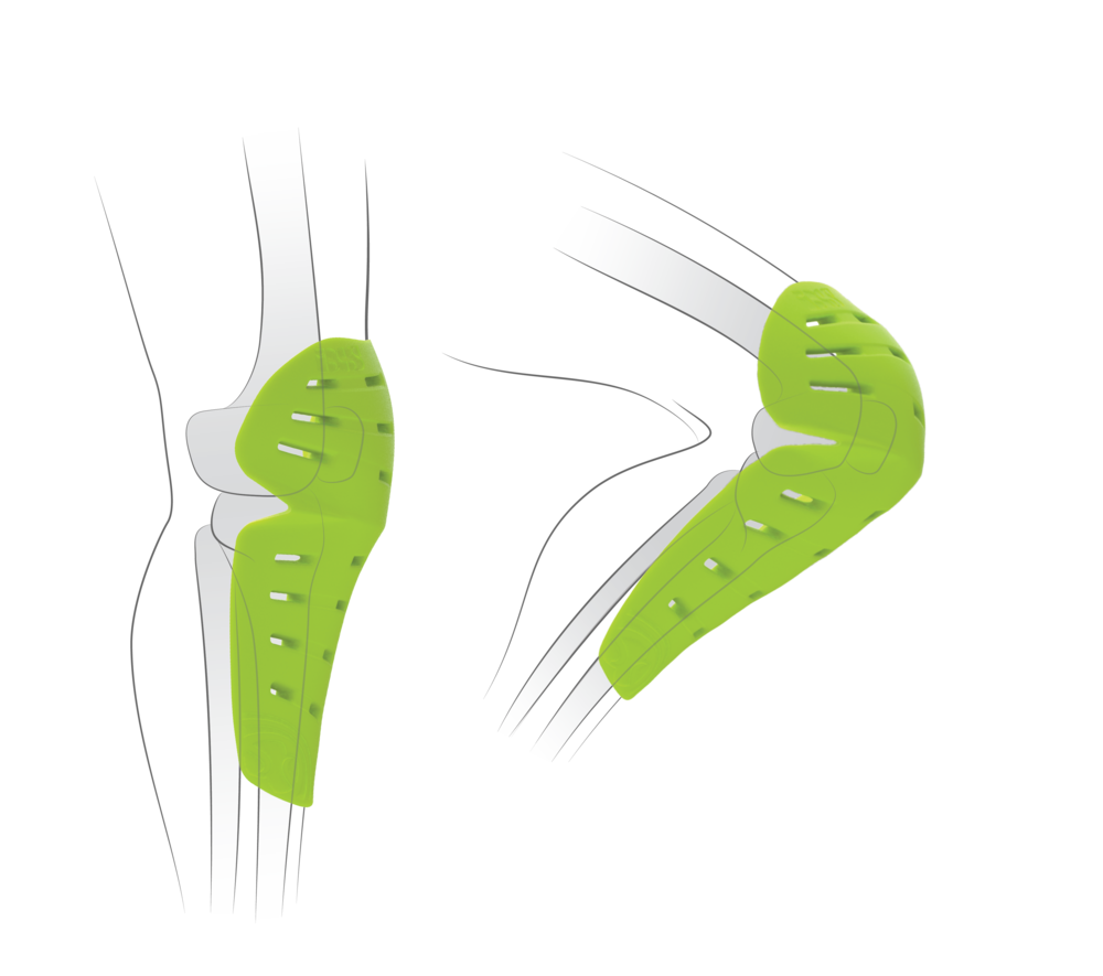 IXS Trigger Knee Pads